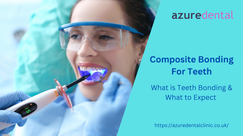 Composite Bonding For Teeth: What Is Teeth Bonding & What To Expect